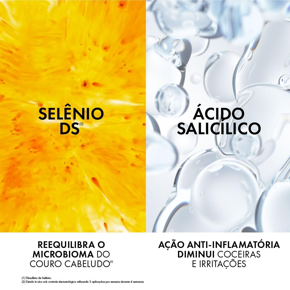 Vichy Dercos DS Shampoo Anticaspa, Tratamento para Cabelos Secos, Elimina 100% da Caspa Visível, Alivia a Coceira e Previne o Reaparecimento por 6 Semanas, 300g
