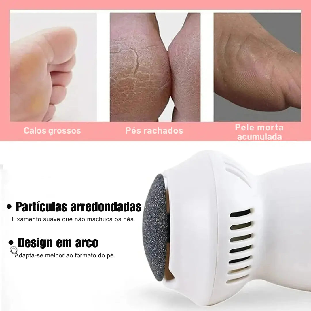 Removedor de calos e rachaduras Beauty Feet