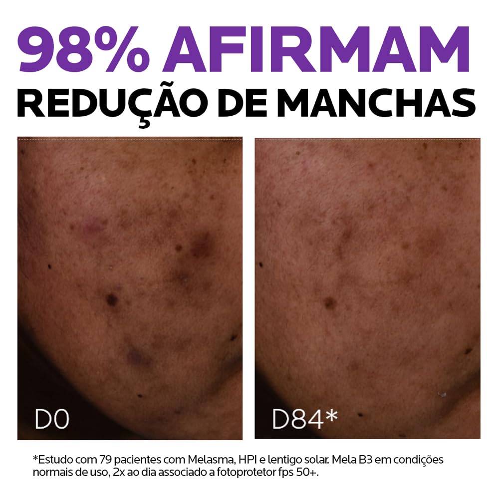 La Roche-Posay Mela B3 Sérum Antimanchas Concentrado, com Novo Ativo Melasyl™ e 10% Niacinamida, Corrige Manchas Solares e Pós-Acne, Previne Reaparecimento, 30ml