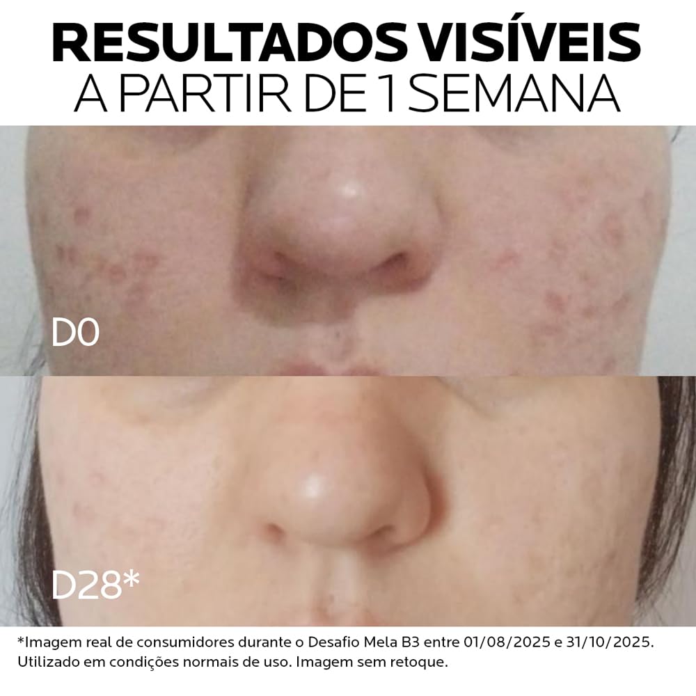 La Roche-Posay Mela B3 Sérum Antimanchas Concentrado, com Novo Ativo Melasyl™ e 10% Niacinamida, Corrige Manchas Solares e Pós-Acne, Previne Reaparecimento, 30ml