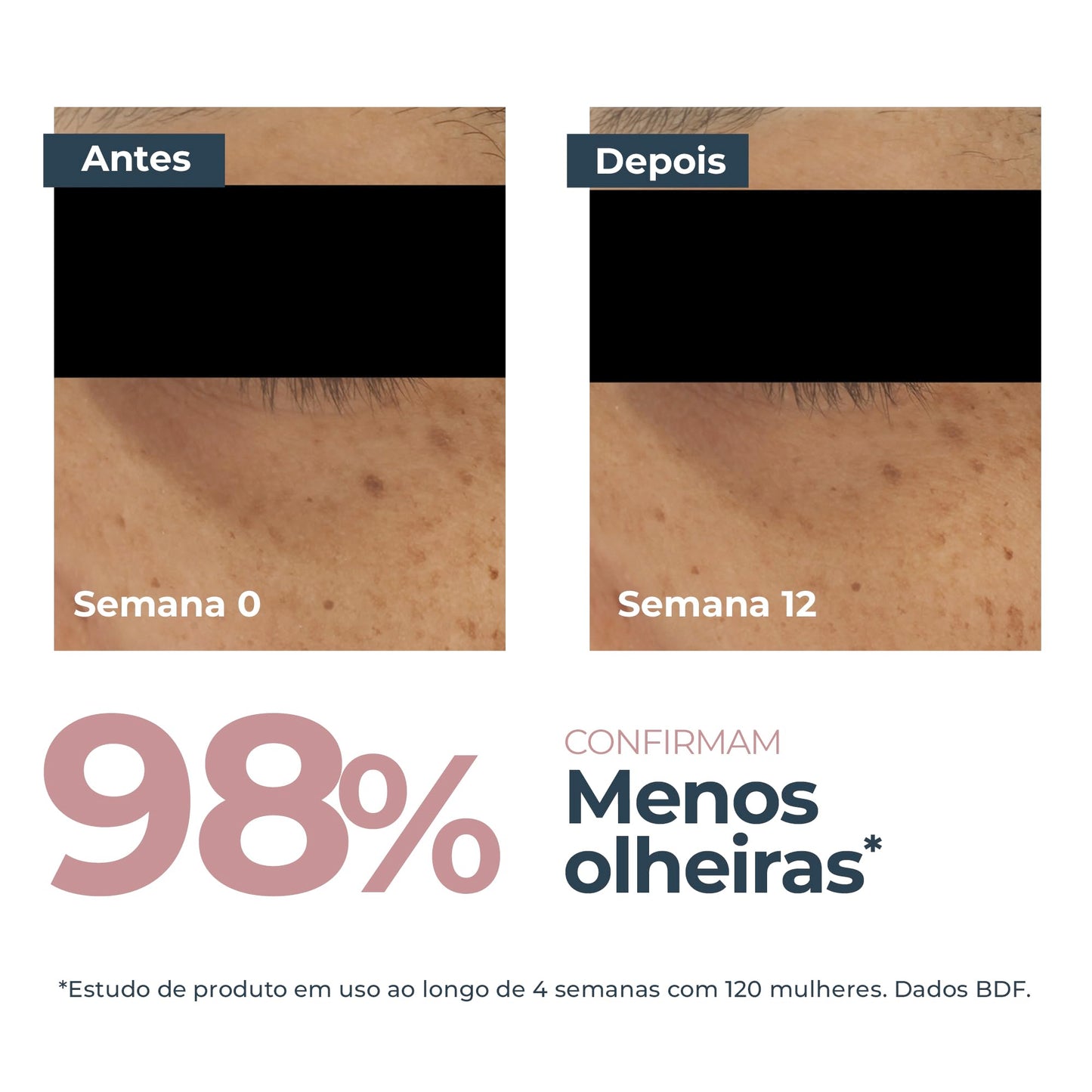 EUCERIN Creme de Olhos Clareador de Olheiras 15ml, Anti-Pigment, Antimanchas, Thiamidol